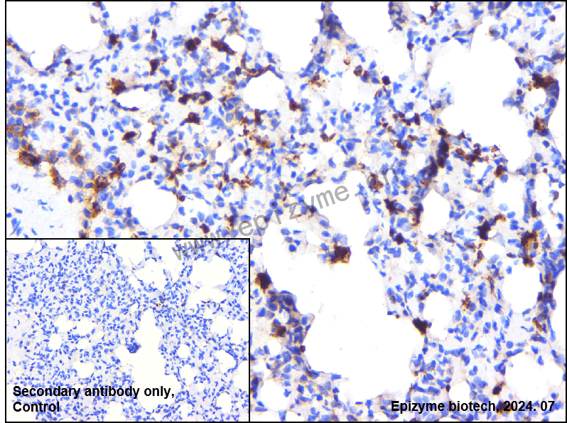 Anti-NOXA2/p67phox Rabbit mAb [72A78B84]