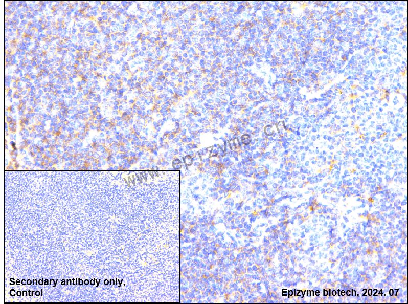 Anti-NOXA2/p67phox Rabbit mAb [72A78B84]
