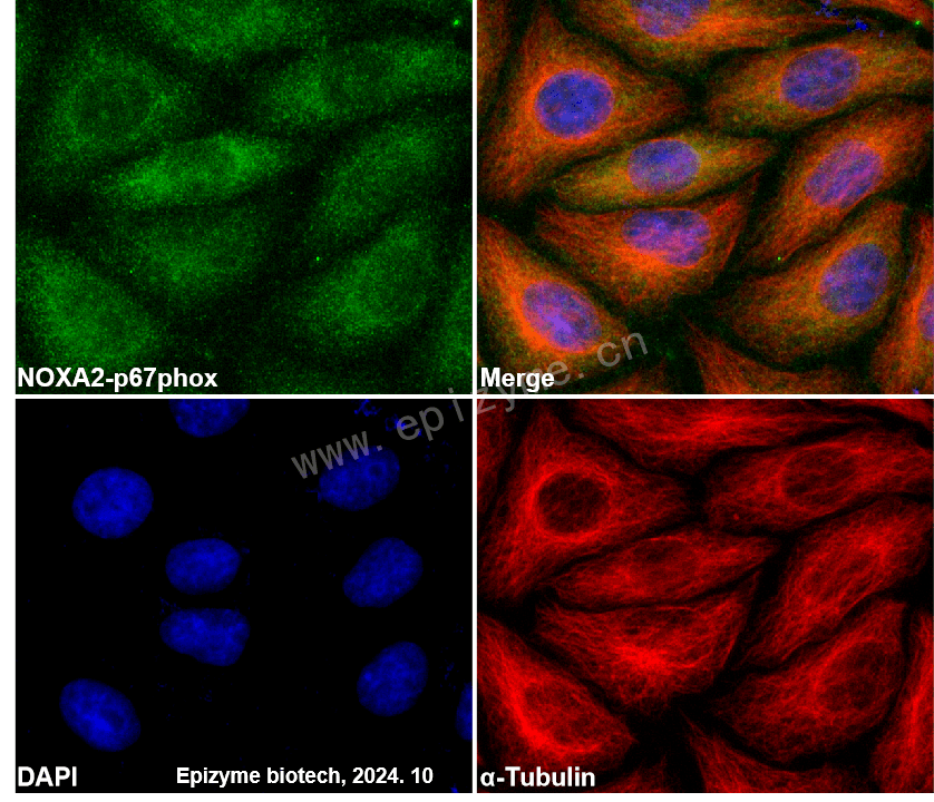 Anti-NOXA2/p67phox Rabbit mAb [72A78B84]