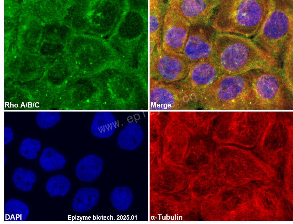 Anti-Rho A/B/C Rabbit mAb [17E16R90]
