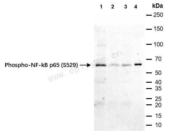 Anti-Phospho-NF-kB p65 (Ser529) Rabbit mAb [42H48G95]