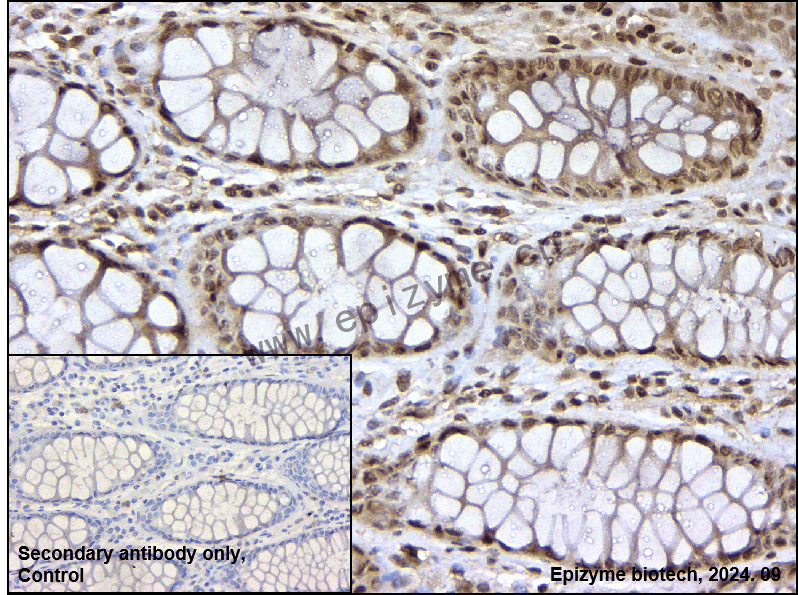 Anti-Phospho-NF-kB p65 (Ser529) Rabbit mAb [42H48G95]