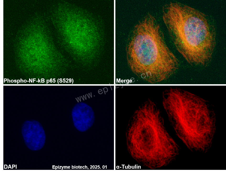 Anti-Phospho-NF-kB p65 (Ser529) Rabbit mAb [42H48G95]