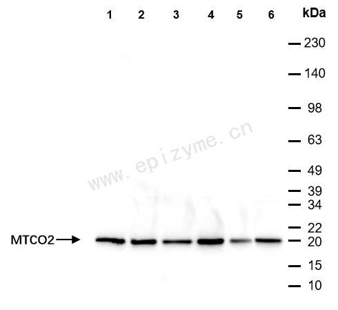 Anti-MTCO2 Rabbit mAb [45E53B75]