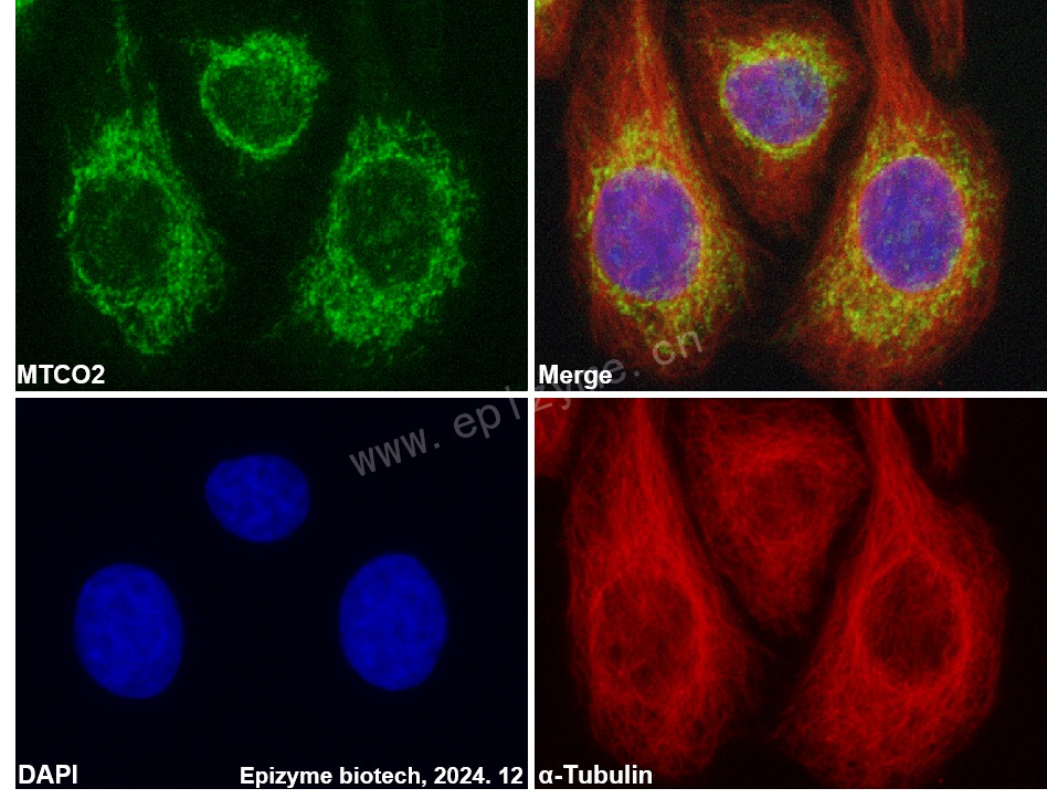 Anti-MTCO2 Rabbit mAb [45E53B75]