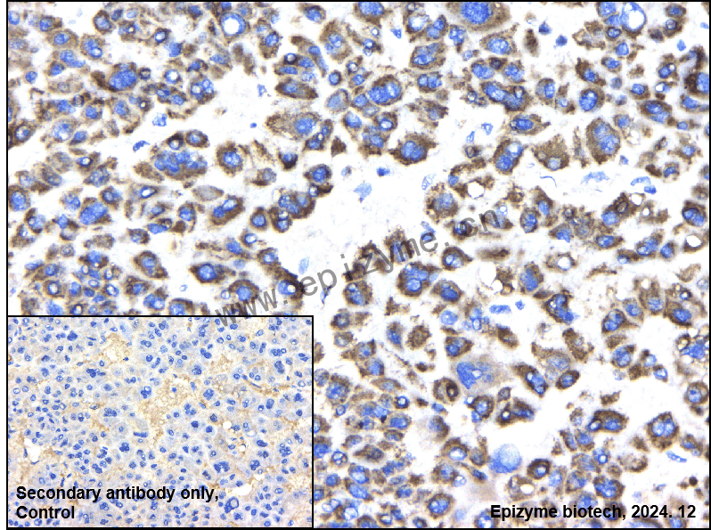 Anti-MTCO2 Rabbit mAb [45E53B75]