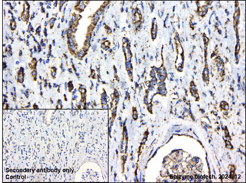 Anti-MTCO2 Rabbit mAb [45E53B75]