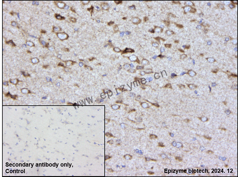 Anti-Furin Rabbit mAb [80M11A38]