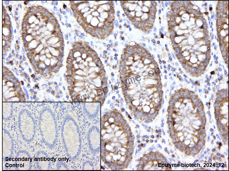 Anti-Furin Rabbit mAb [80M11A38]