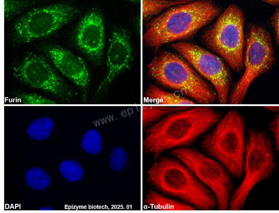 Anti-Furin Rabbit mAb [80M11A38]