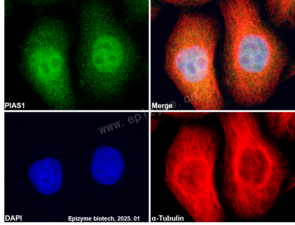 Anti-PIAS1 Rabbit mAb [81Q64F53]