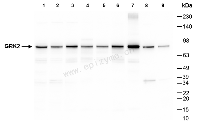 Anti-GRK2 Rabbit mAb [84S54K07]