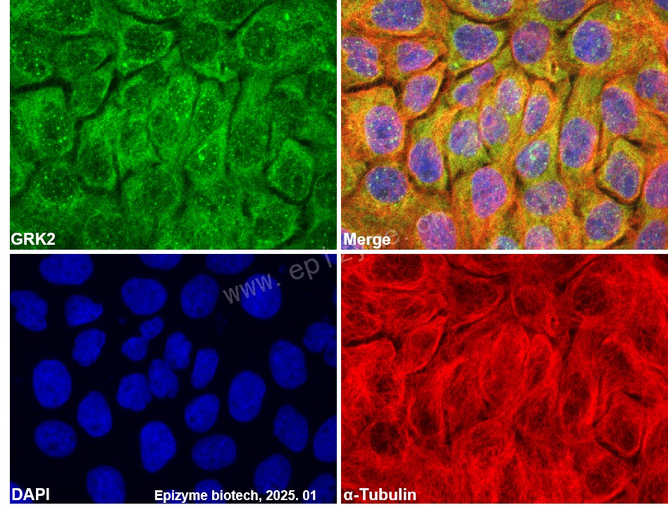 Anti-GRK2 Rabbit mAb [84S54K07]