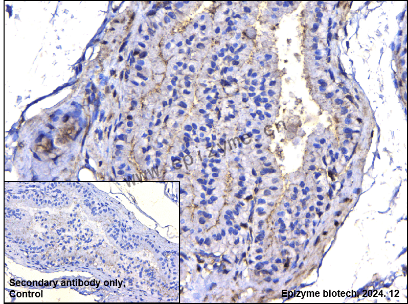 Anti-TOR4A Rabbit mAb [34S10P44]