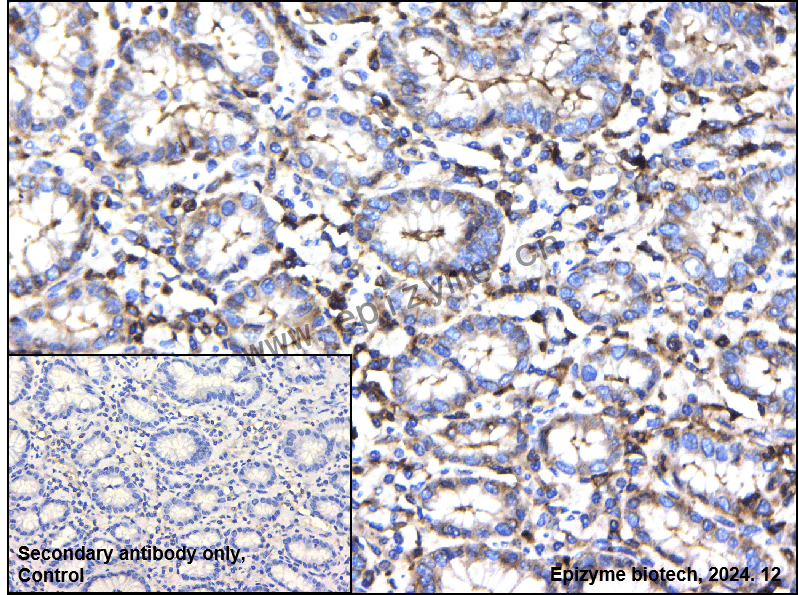 Anti-TOR4A Rabbit mAb [34S10P44]