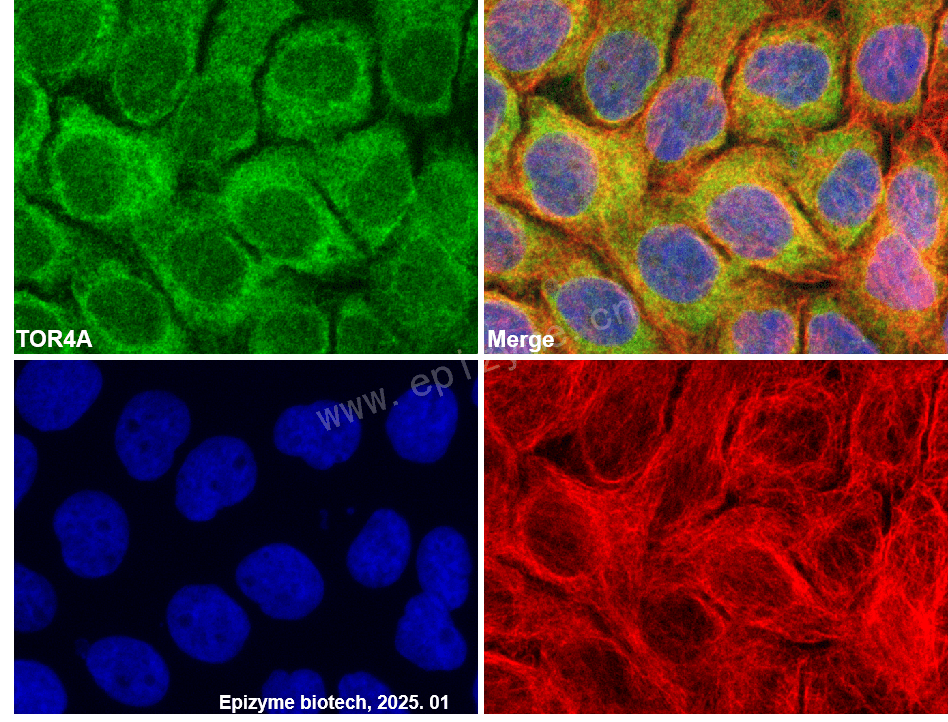 Anti-TOR4A Rabbit mAb [34S10P44]