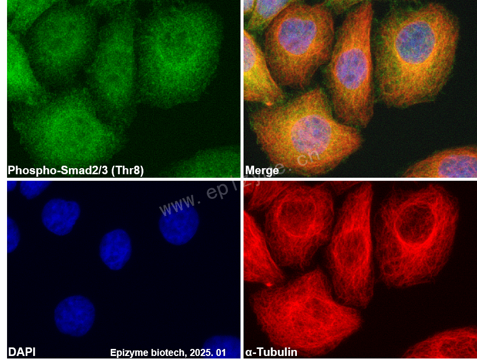 Anti-Phospho-Smad2/3 (Thr8) Rabbit mAb [31J01M70]