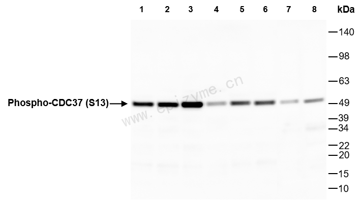 Anti-Phospho-CDC37 (Ser13) Rabbit mAb [30H41A90]