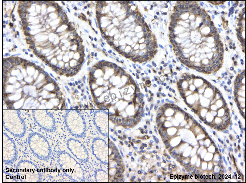 Anti-Phospho-CDC37 (Ser13) Rabbit mAb [30H41A90]