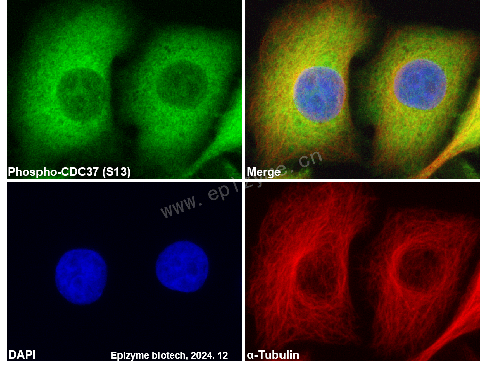 Anti-Phospho-CDC37 (Ser13) Rabbit mAb [30H41A90]