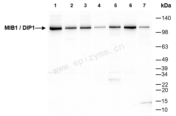 Anti-MIB1 Rabbit mAb [93P43I68]