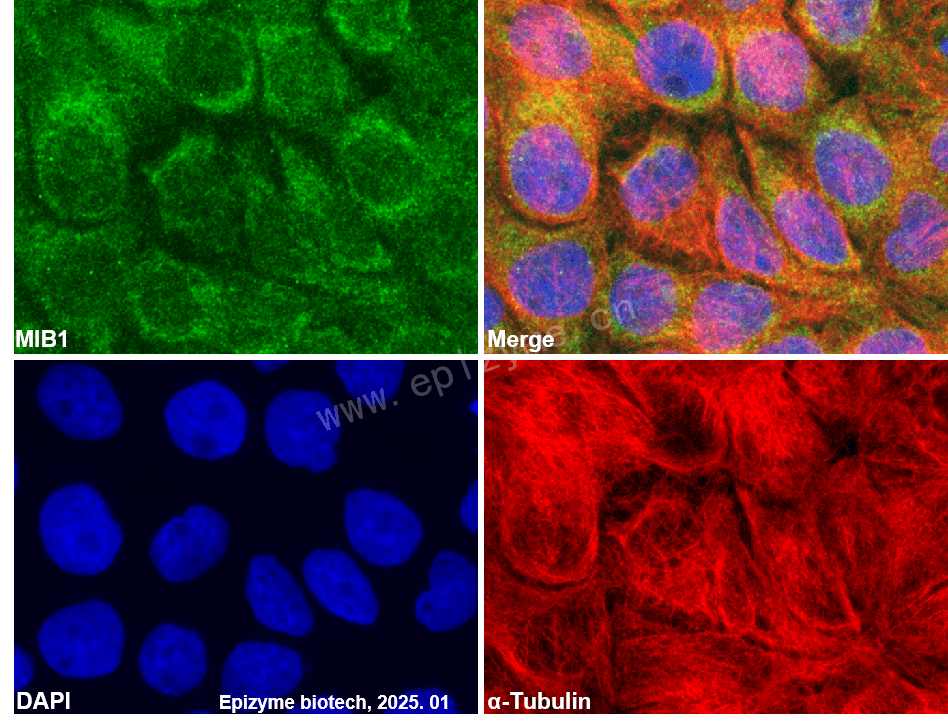 Anti-MIB1 Rabbit mAb [93P43I68]