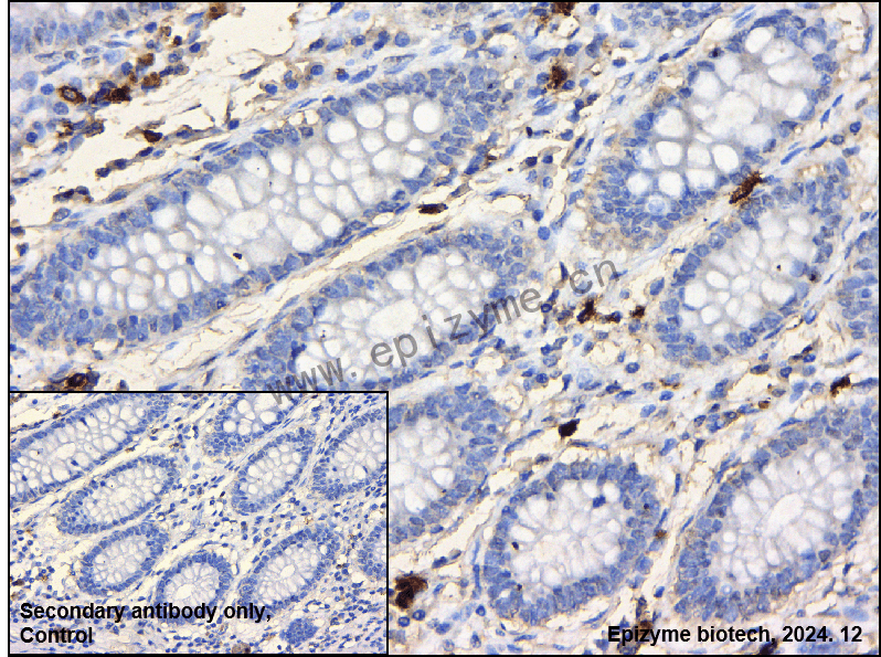 Anti-MIB1 Rabbit mAb [93P43I68]
