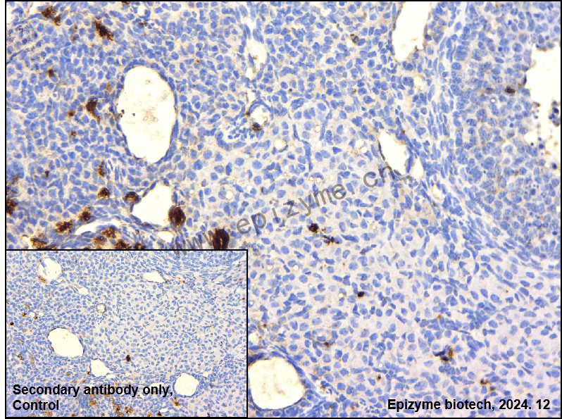 Anti-MIB1 Rabbit mAb [93P43I68]