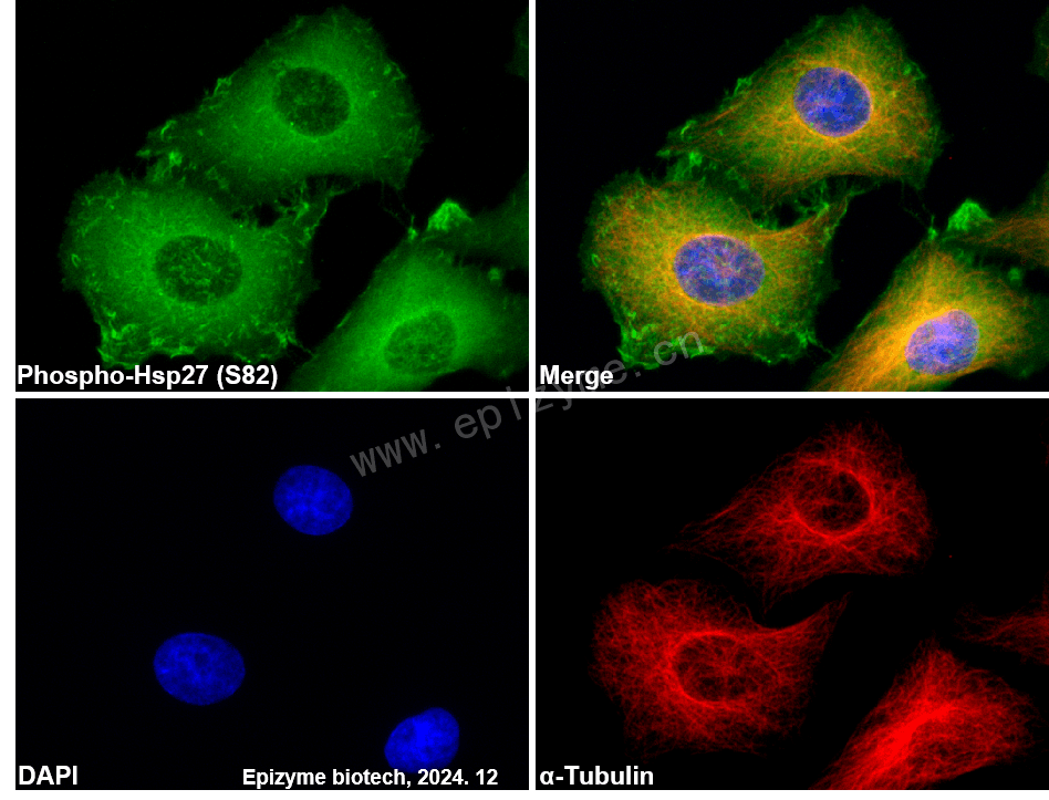 Anti-Phospho-Hsp27 (Ser82) Rabbit mAb [98G07M53]