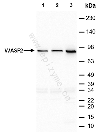 Anti-WASF2/WAVE2 Rabbit mAb [81H55R20]