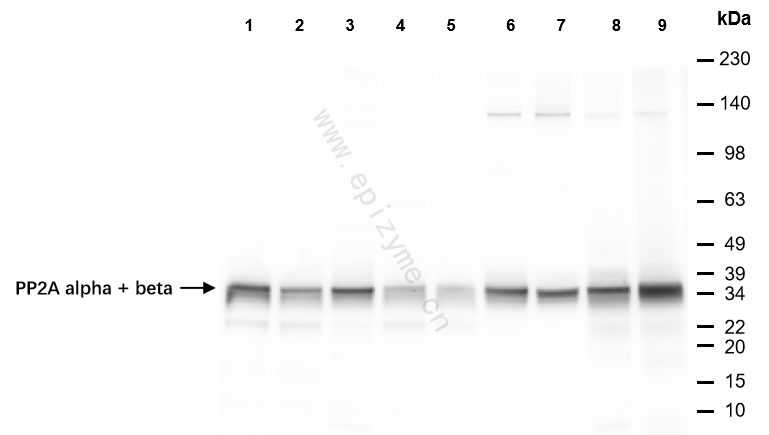 Anti-PP2A alpha/beta Rabbit mAb [95Q18P88]