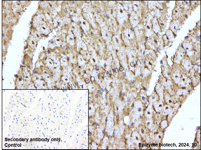 Anti-PP2A alpha/beta Rabbit mAb [95Q18P88]