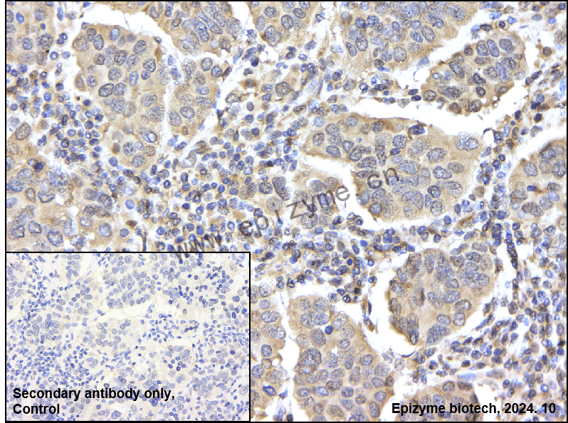Anti-PP2A alpha/beta Rabbit mAb [95Q18P88]