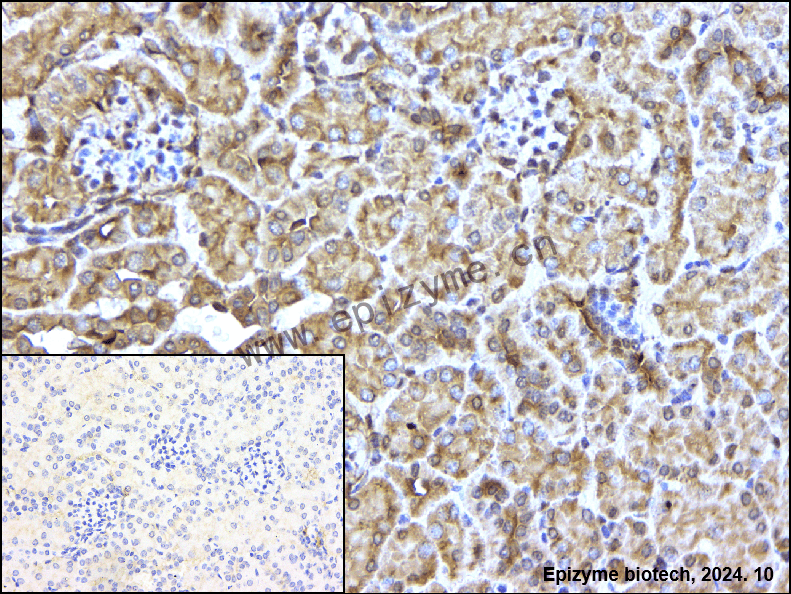 Anti-PP2A alpha/beta Rabbit mAb [95Q18P88]