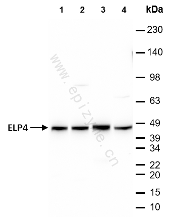 Anti-Elp4 Rabbit mAb [75G07M89]