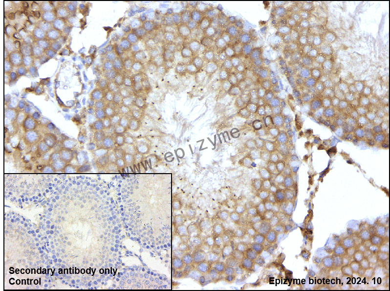 Anti-Elp4 Rabbit mAb [75G07M89]