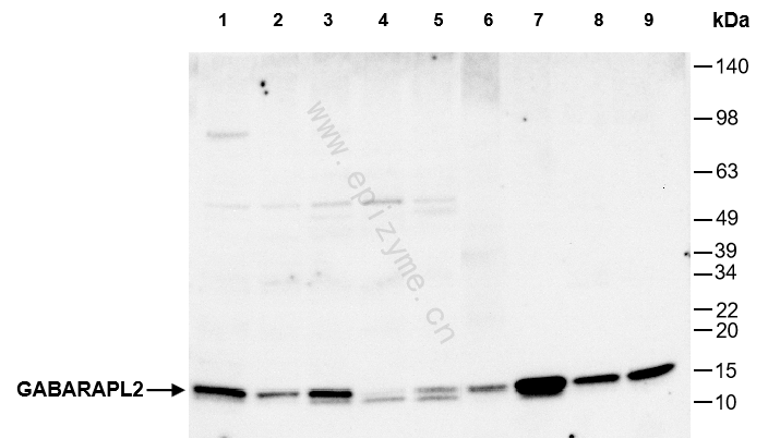 Anti-GABARAPL2 Rabbit mAb [40Q61B09]