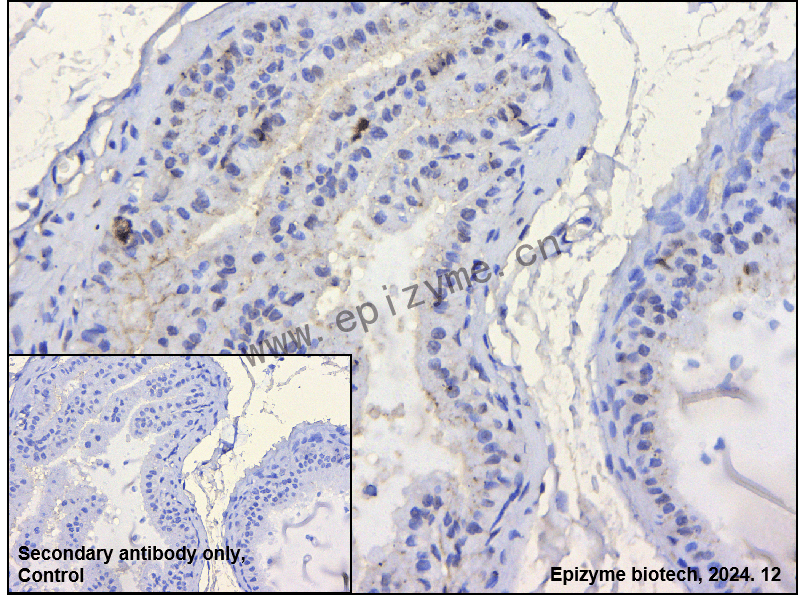 Anti-GABARAPL2 Rabbit mAb [40Q61B09]