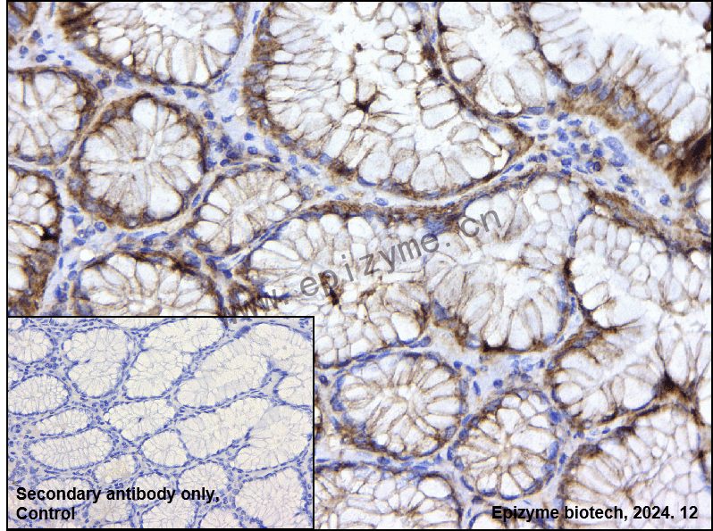 Anti-GABARAPL2 Rabbit mAb [40Q61B09]