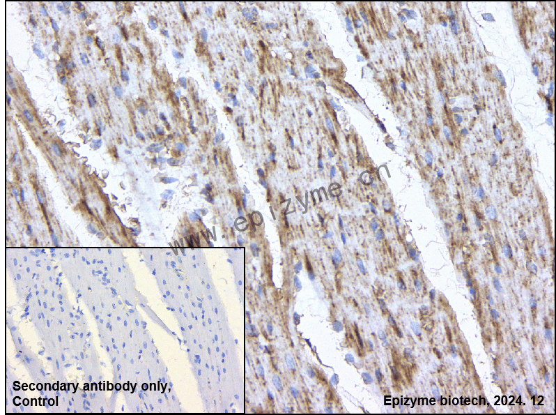 Anti-Dcp1a Rabbit mAb [32F54L03]