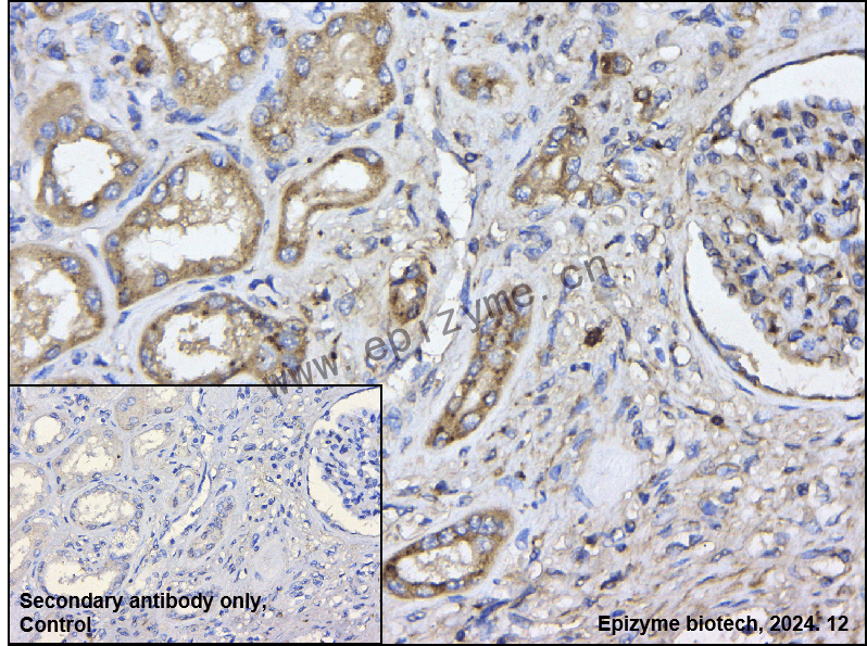 Anti-Dcp1a Rabbit mAb [32F54L03]