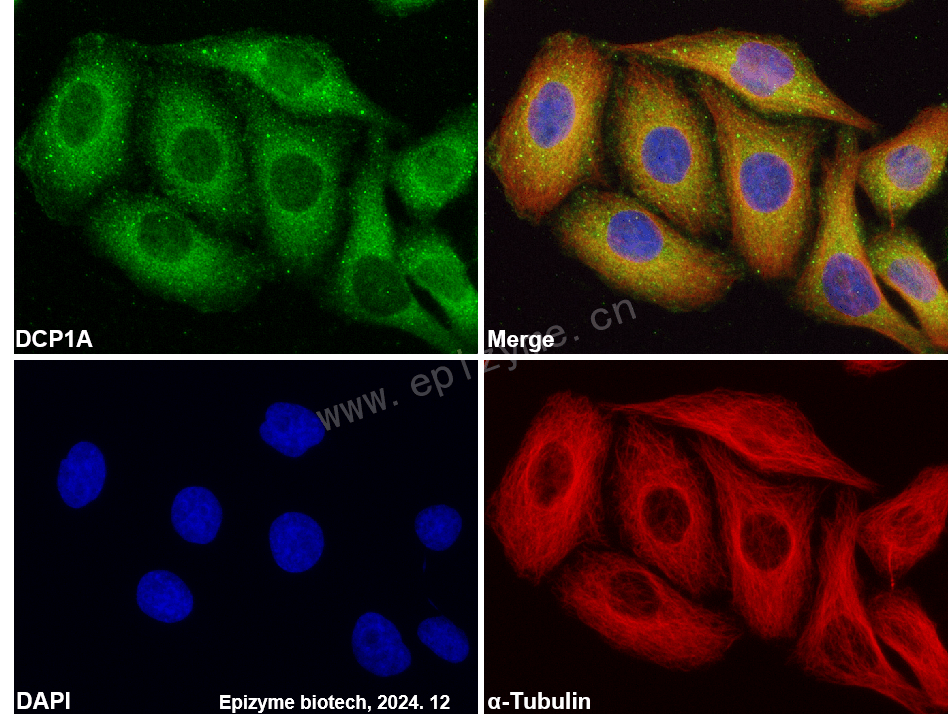 Anti-Dcp1a Rabbit mAb [32F54L03]