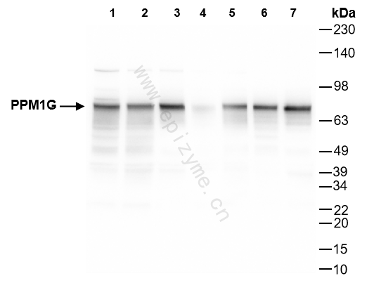 Anti-PPM1G Rabbit mAb [85K95G84]