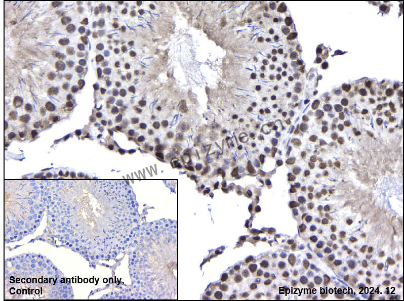 Anti-PPM1G Rabbit mAb [85K95G84]