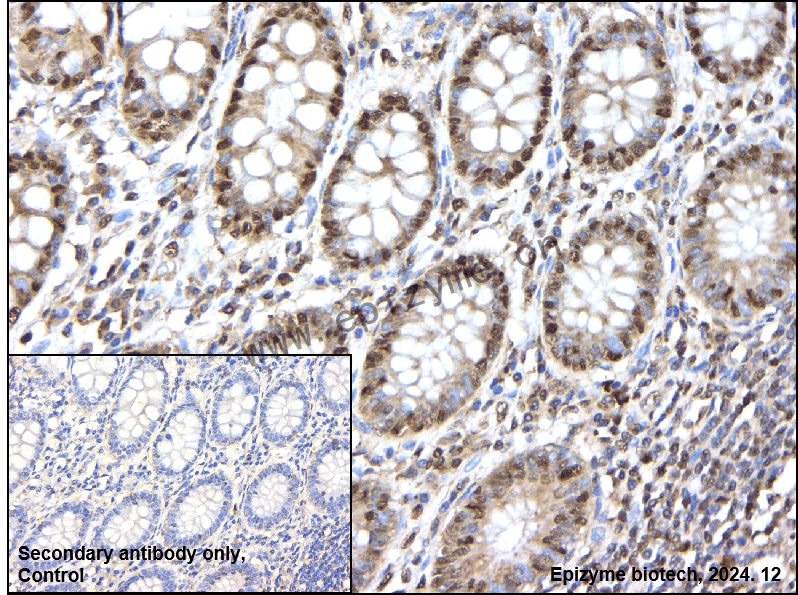 Anti-PPM1G Rabbit mAb [85K95G84]