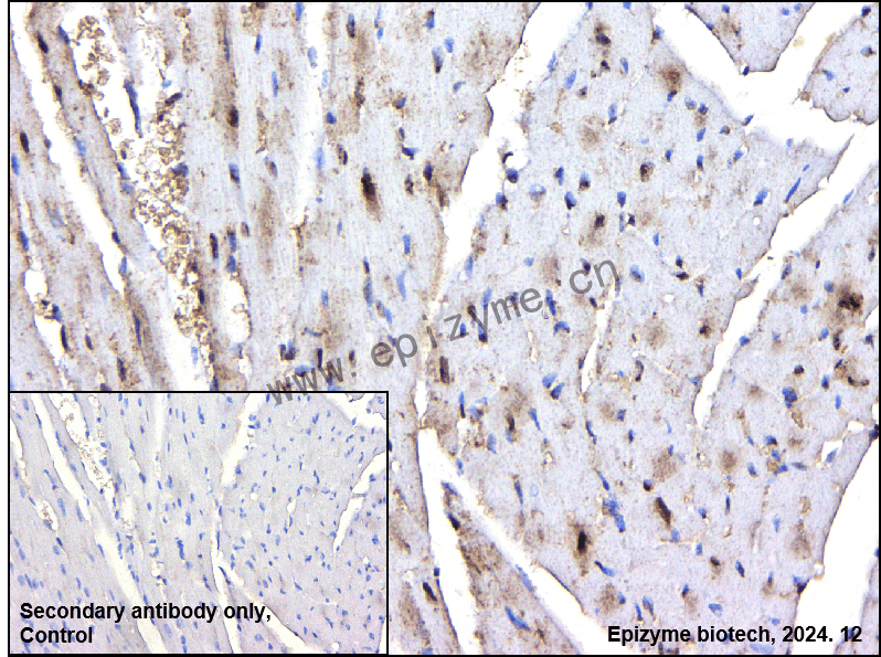 Anti-PPM1G Rabbit mAb [85K95G84]