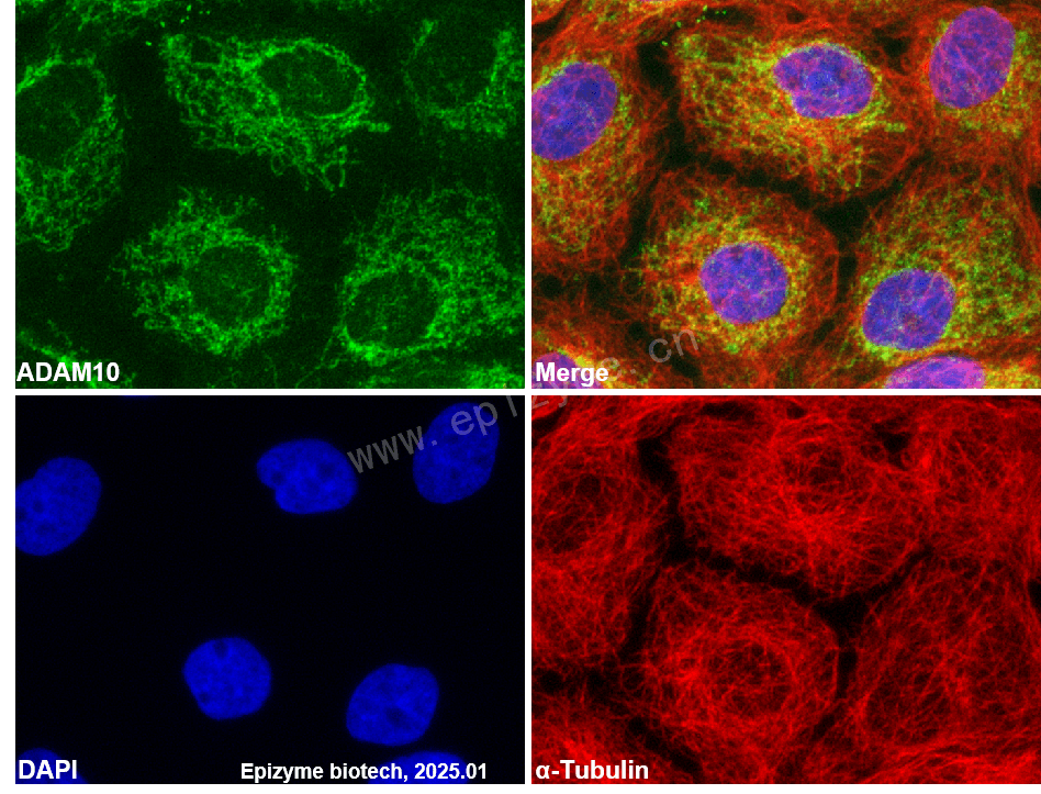 Anti-ADAM10 Rabbit mAb [84L55I30]