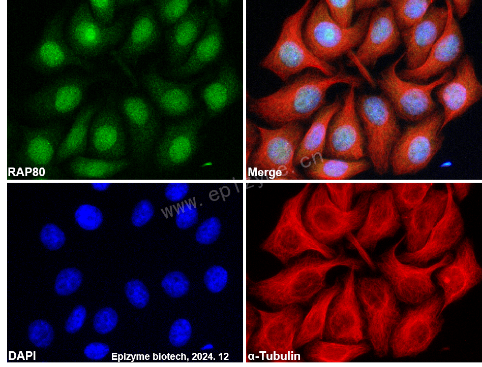 Anti-RAP80 Rabbit mAb [38A10D24]