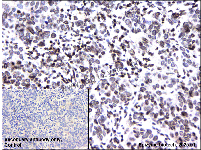 Anti-RAP80 Rabbit mAb [38A10D24]