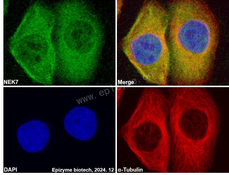 Anti-NEK7 Rabbit mAb [66J20J81]